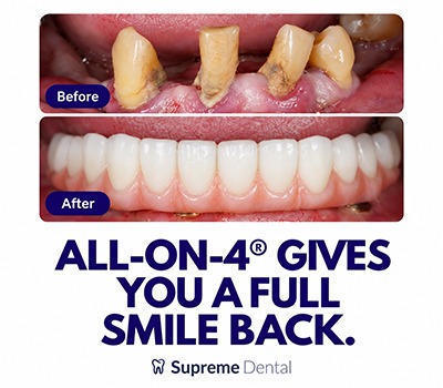 Supreme Dental Offer